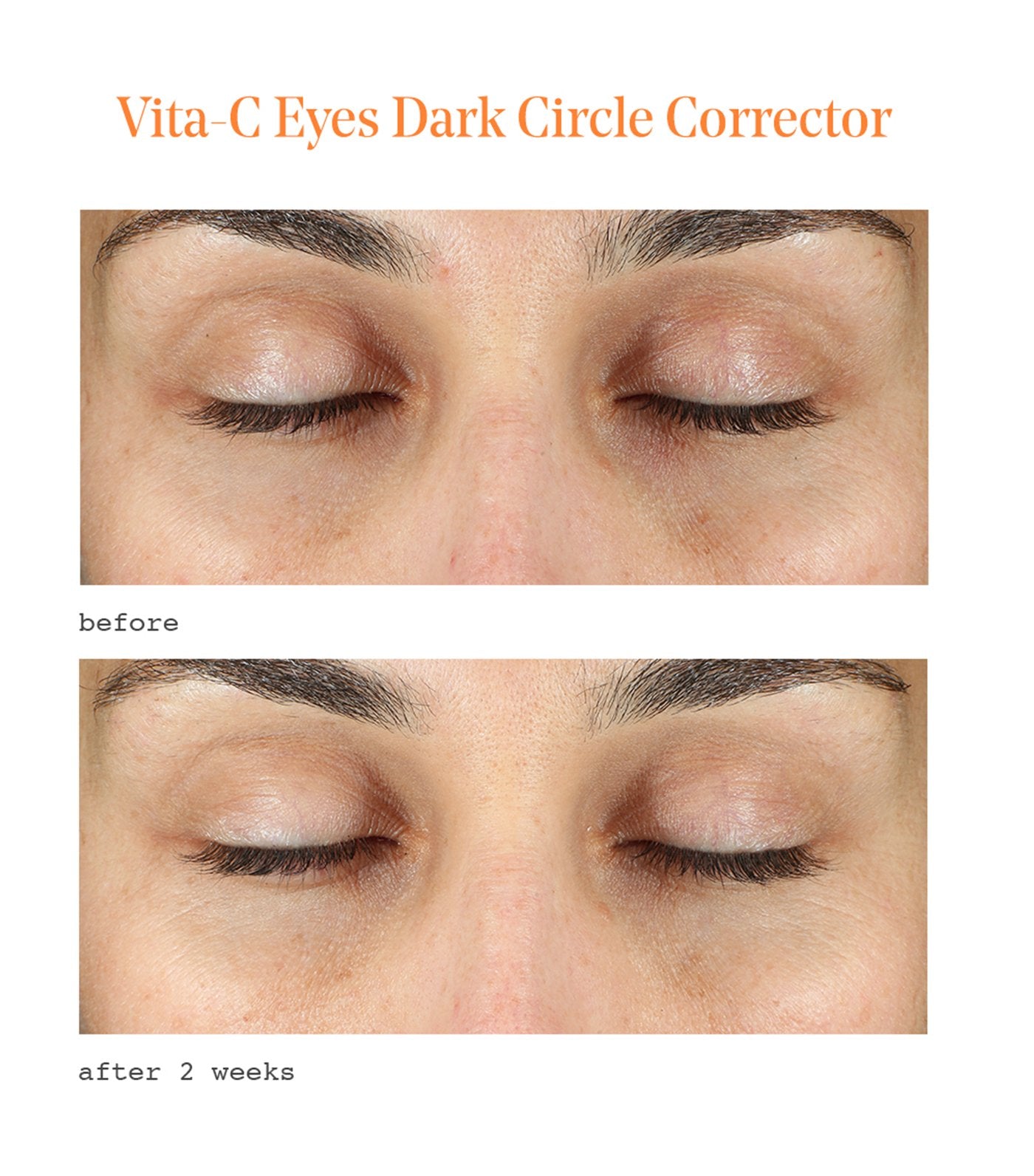 Vita-C Eyes Dark Circle Corrector