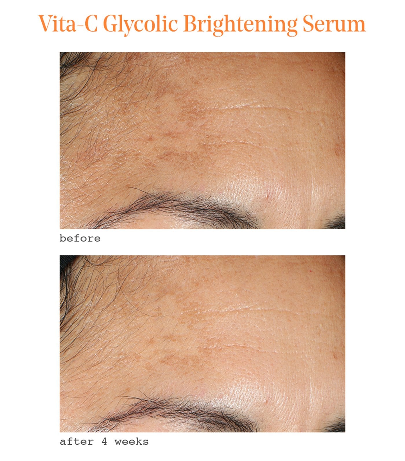Vita-C Glycolic Brightening Serum