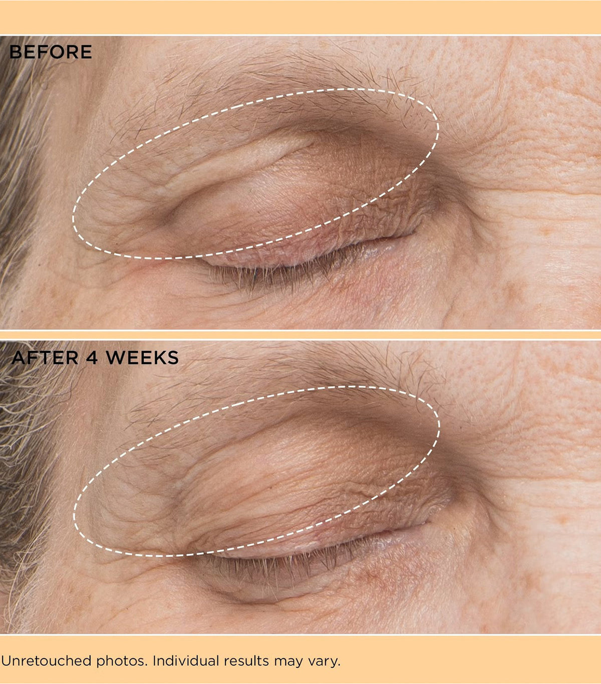 Neuropeptide Eyelid Lift Serum