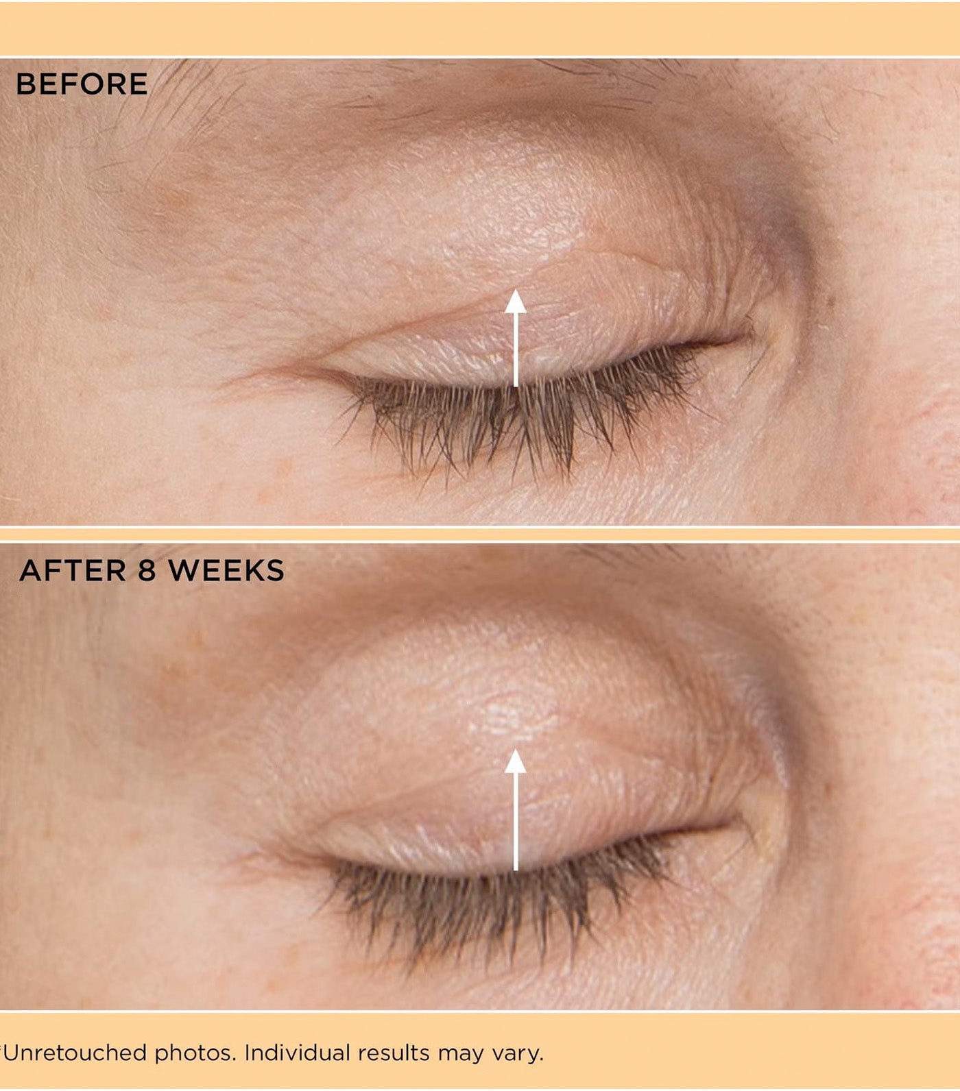 Neuropeptide Eyelid Lift Serum