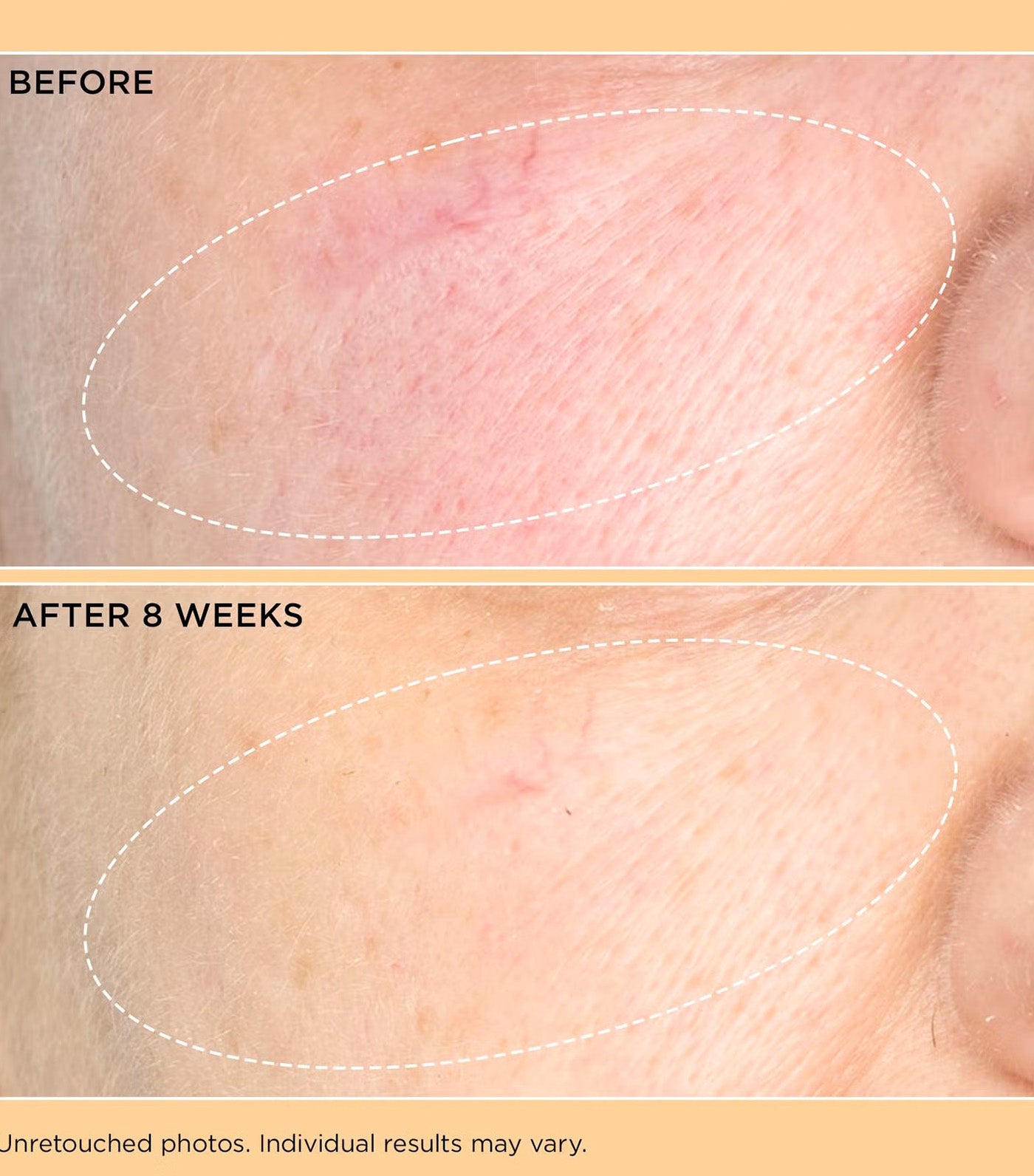 Neuropeptide Pro-Strength Firming Moisturizer