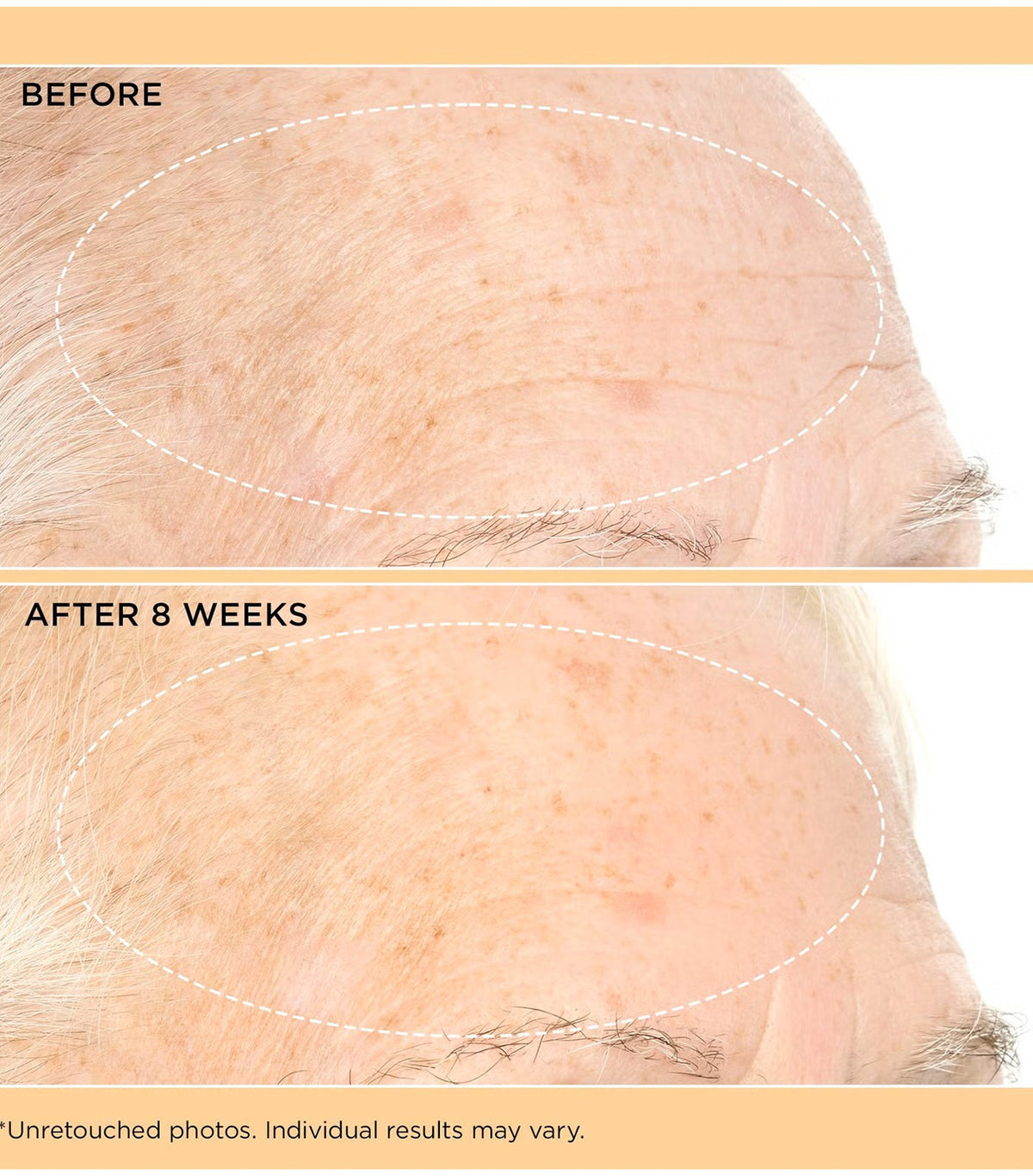 Neuropeptide Pro-Strength Firming Moisturizer